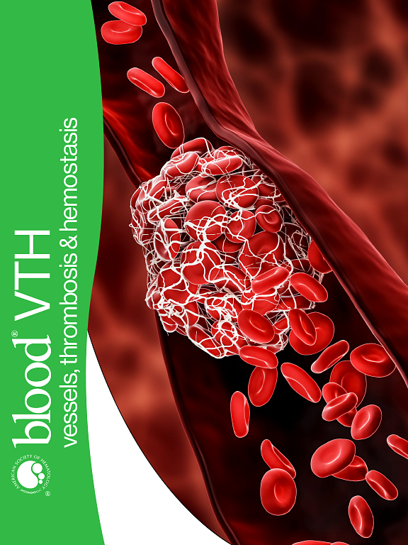 Go to journal home page - Blood Vessels, Thrombosis & Hemostasis